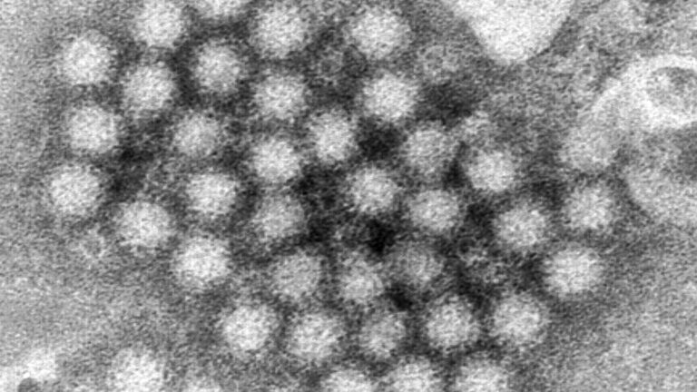 A Norovirus Outbreak Has Been Reported In Chicago. Symptoms To