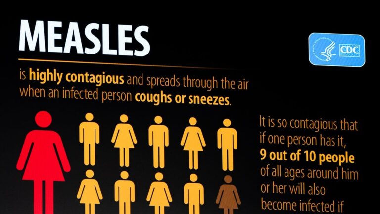 The measles case at o'hare airport places tippeccanoe province on